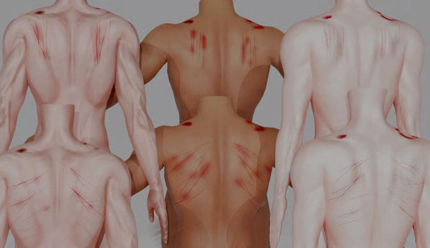 HOT night — Mark & Damage texture set (Akii,Dolly molly,Eboy)