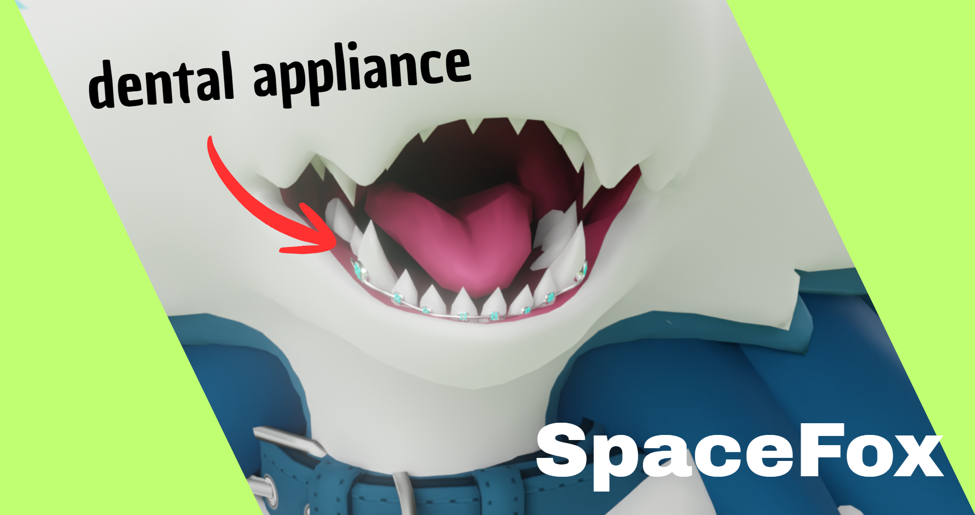 dental appliance
