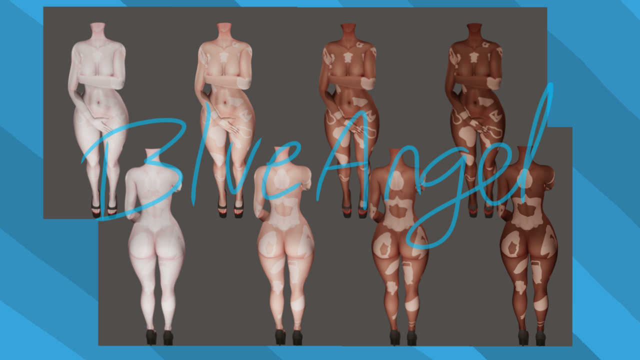 Vitiligo Textures for Zinpia E-girl (FREE IN SERVER)