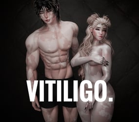 4K VITILIGO IMPERFECTION TEXTURE - FEMALE